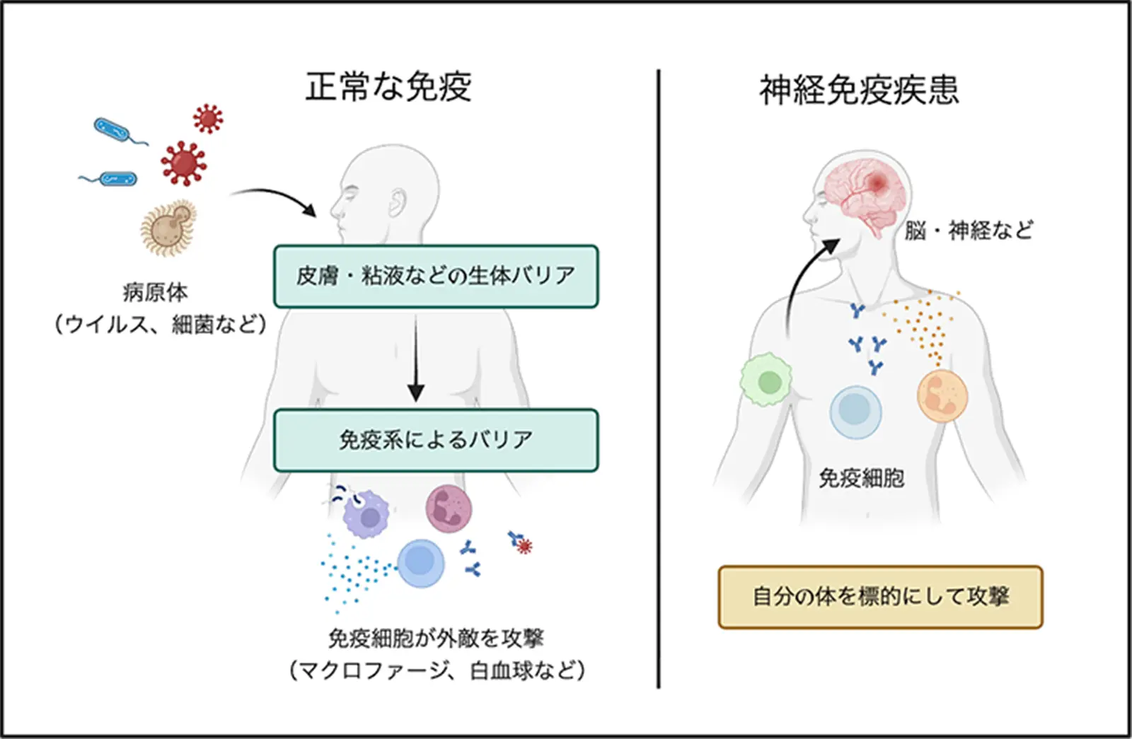 神経免疫疾患とは